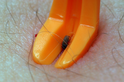 Tique en cours d'extraction